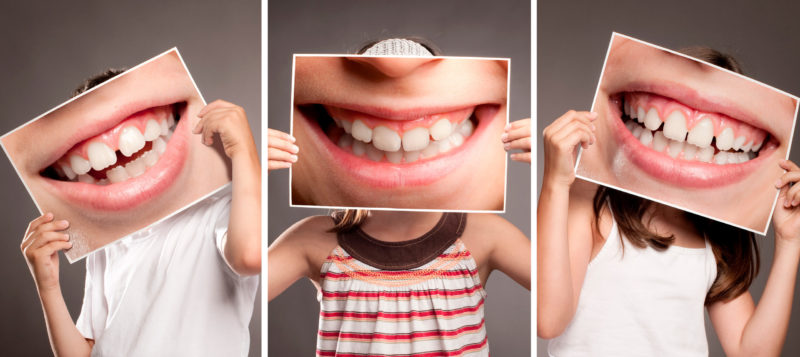 Group,Of,Children,Holding,Picture,Of,Mouth,Smiling,Showing,Her grupo de niños sosteniendo una foto de la boca sonriendo mostrando sus dientes