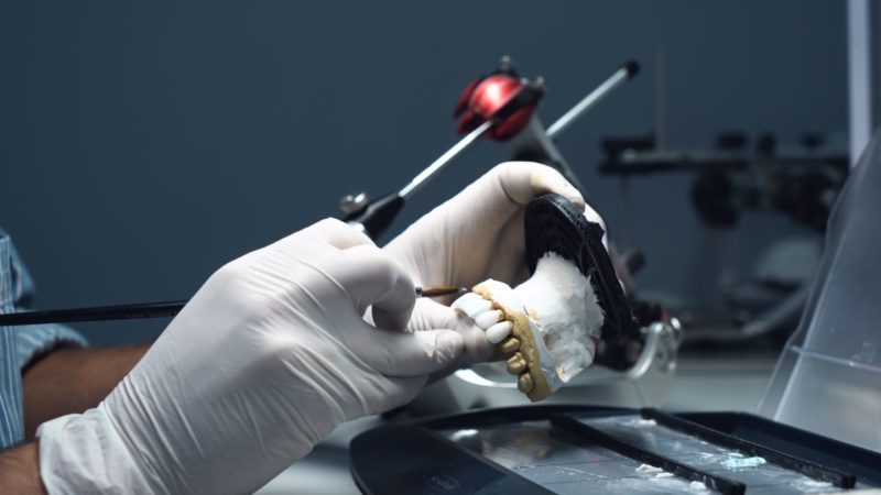 Dental,Technician,Creates,Dental,Prostheses.,Laboratory.,Close-up Técnico dental crea prótesis dentales